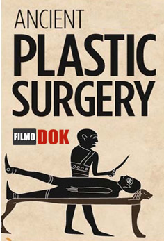 Пластическая хирургия в древности / Ancient Plastic Surgery (2004)